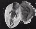 Ein Fetus ist kein Zellhaufen (Photographie von Lennart Nilsson).jpg